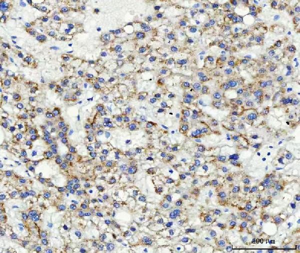 anti-ABCB4 / MDR3 antibody