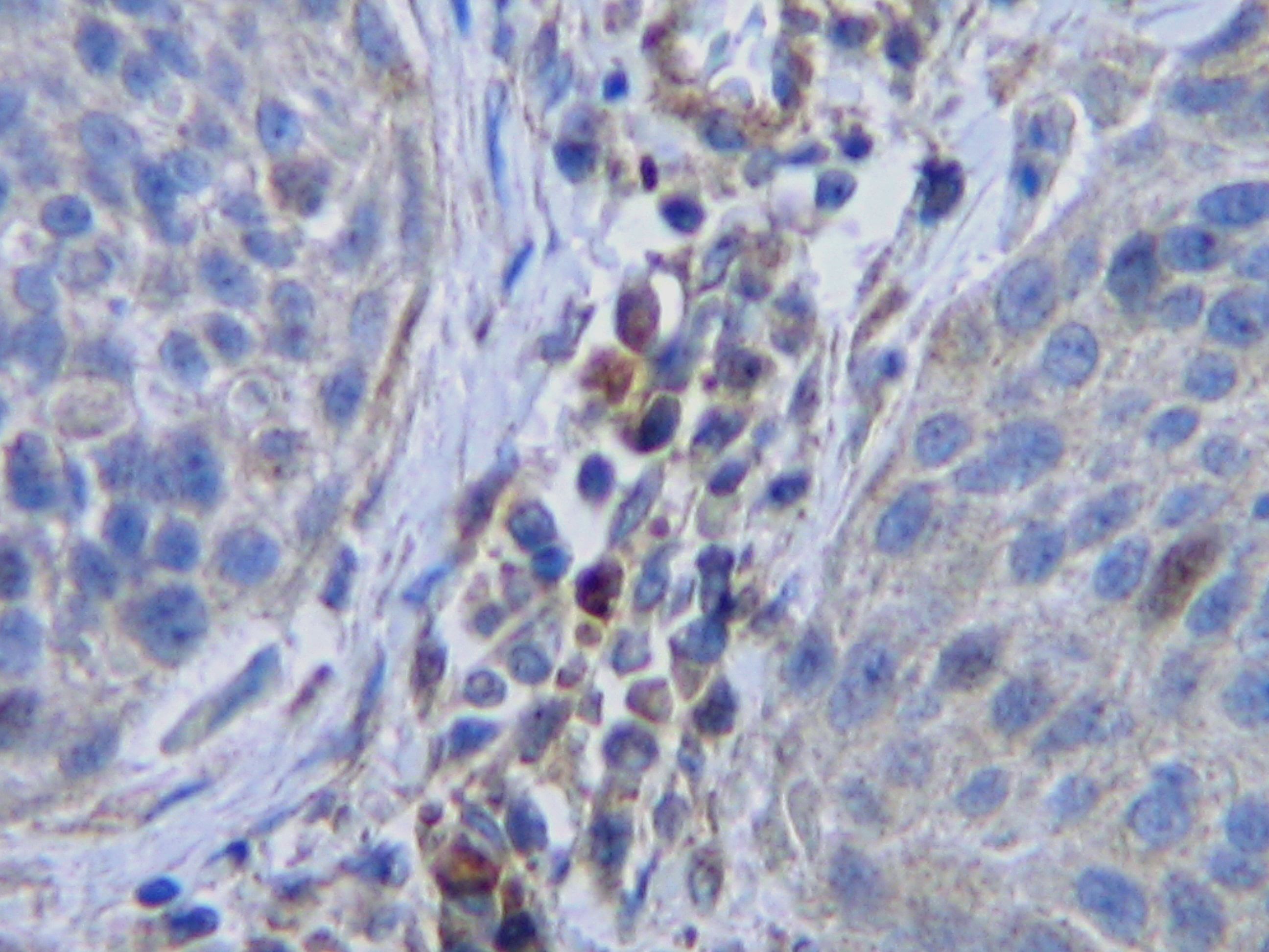 anti-M-CЅF antibody