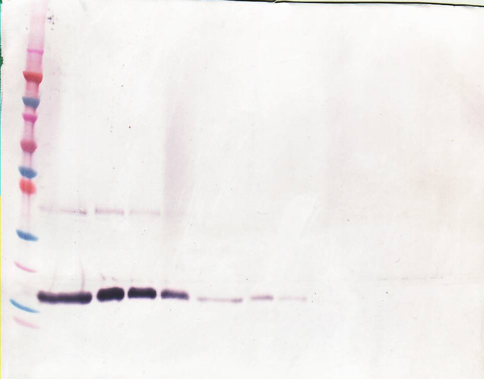 anti-M-CЅF antibody