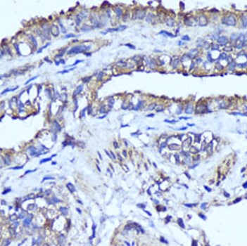anti-CD44 antibody