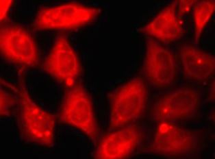 anti-MID1 antibody