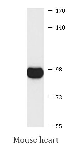 anti-MID1 antibody