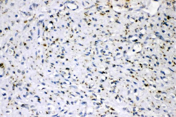 anti-Adipophilin antibody