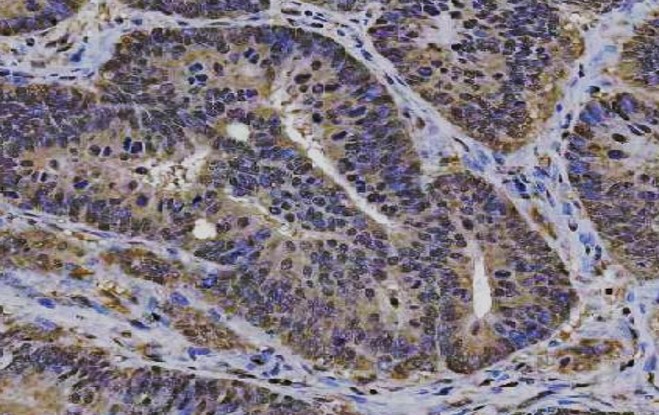 anti-PLEKHG5 antibody
