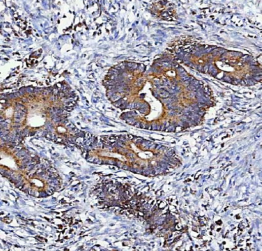anti-MGME1 antibody