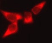 anti-AK1 antibody