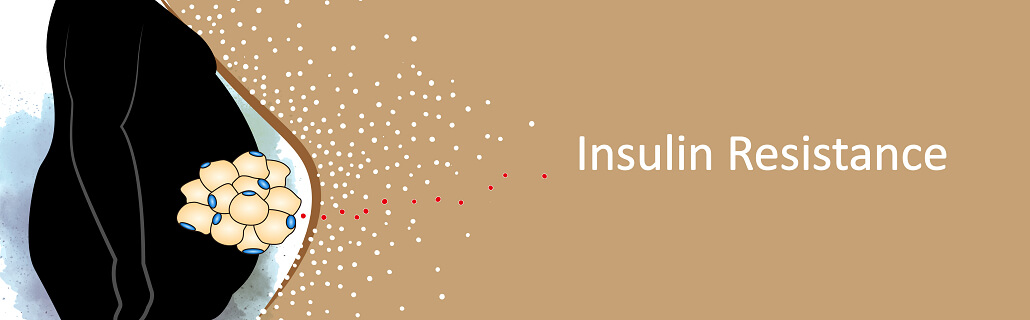 Insulin Resistance