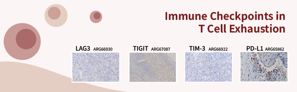 Immune Checkpoints in T Cell Exhaustion