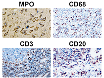IHC-P panel showing inflammatory cell markers CD3, CD20, CD68, and MPO expression in human and mouse tissue, detected using the Inflammatory Cell Antibody Panel.