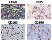 TAM marker panel used for IHC-P detection of CD68, iNOS, CD163, and CD206, enabling visualization of macrophage polarization states (M1-like and M2-like) in human tissues.