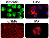 CAF marker panel (ARG30347) used for ICC/IF detection of Vimentin, FSP-1, α-SMA, and FAP, demonstrating fibroblast activation and stromal changes associated with tumor microenvironment remodeling.