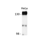 Western blot: 25 µg of HeLa cell lysate stained with anti-SIRT1 antibody at 1:500 dilution.