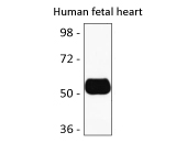 Western blot: Human fetal heart lysate stained with anti-Estrogen related Receptor gamma antibody.