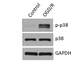 Western blot showing increased p38 phosphorylation (p-p38 Thr180/Tyr182) in OGD/R-treated cells compared to control, detected with p38 and phospho-p38 antibodies, with GAPDH as loading control.