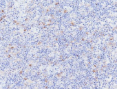 Immunohistochemistry (IHC-P) staining of human tonsil tissue using anti-TIM-3 antibody, showing TIM-3 expression in formalin-fixed paraffin-embedded sections with Tris-EDTA antigen retrieval (pH 9.0).