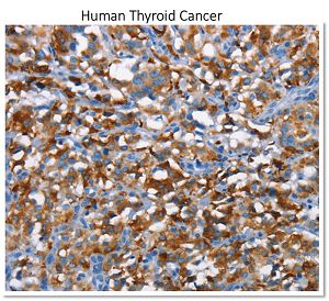 CD226 Antibody IHC-P image