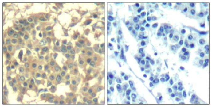 c-MET Antibody IHC-P image