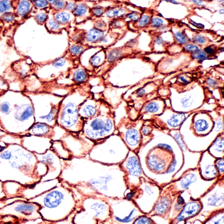 CD44 Antibody IHC-P image