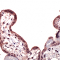 NRF2 Antibody IHC-P image