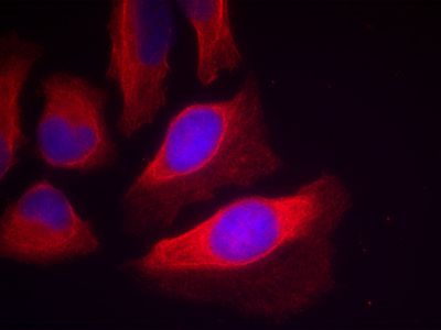 IKK beta phospho (Tyr199) antibody