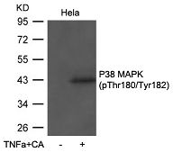 P38 MAPK phospho (Thr180/Tyr182) antibody