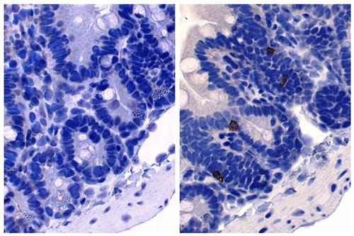Immunohistochemistry: Paraffin-embedded Mouse small intestine tissue stained with ARG21591 Rat anti-Mouse IgE antibody [23G3] (right) followed by an HRP-conjugated secondary antibody, DAB and hematoxylin.