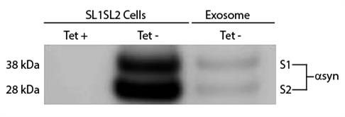 Western blot: H4 human neuroglioma cell line coexpressing human alphasyn tagged with either the amino-terminal (SL1) or the carboxyterminal fragments (SL2) of Gaussia princeps luciferase (SL1SL2 cells) were treated with tetracycline to block the expression of SL1 and SL2 and SL1SL2 exosomes were resolved by electrophoresis, transferred to PVDF membrane, and stained with anti-CD9 followed by ARG23710 Goat anti-Mouse IgA + IgG + IgM antibody (HRP) (pre-adsorbed) and chemiluminescent detection.