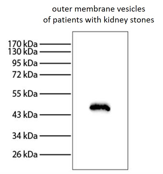 Western blot: Proteins derived from outer membrane vesicles of patients with kidney stones were stained with anti-EF-Tu antibody followed by ARG23712 Rabbit anti-Mouse IgG (H+L) (HRP).