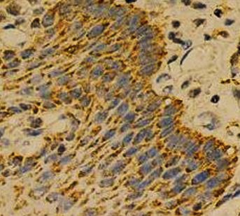 Immunohistochemistry: Paraffin-embedded Human esophagus stained with ARG57759 anti-GNAO1 antibody at 1:100 dilution.