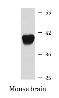 Western blot: 25 microg of Mouse brain lysate stained with ARG57759 anti-GNAO1 antibody at 1:1000 dilution.
