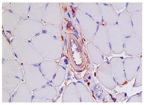 Immunohistochemistry: Paraffin-embedded Mouse adductor muscle day 3 post femoral artery ligation was stained with ARG23770 Goat anti-Rat IgG (H+L) antibody (Biotin), pre-adsorbed and then Streptavidin-HRP, hematoxylin, and AEC.