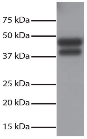 Western blot: Total cell lysates from Jurkat cells were resolved by electrophoresis, transferred to PVDF membrane, and probed with ARG22343 anti-DR5 antibody. Proteins were visualized using ARG23768 Goat anti-Rabbit IgG (H+L) antibody (HRP), pre-adsorbed and chemiluminescent detection.