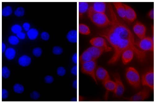 Immunofluorescence: Human pancreatic carcinoma cell line MIA PaCa-2 was stained with Mouse anti-Cytokeratin 18 (right) followed by ARG23795 Goat anti-Mouse IgG (H+L) antibody (TRITC), pre-adsorbed and DAPI.