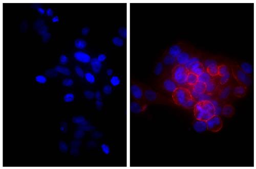 Immunofluorescence: Human epithelial carcinoma cell line HEp-2 was stained with Mouse anti-Human CD44 (right) followed by ARG23777 Goat anti-Mouse IgA + IgG + IgM antibody (TRITC) (pre-adsorbed) and DAPI.
