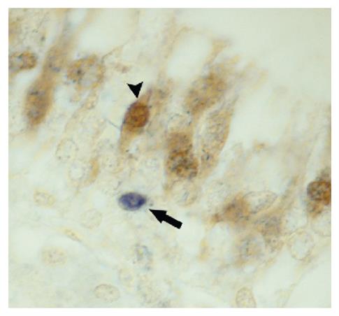 Immunohistochemistry: Paraffin-embedded chicken nasal cavity section infected with H7N1 highly pathogenic avian influenza virus was stained with anti-IAV NP followed by ARG23778 Goat anti-Mouse IgA + IgG + IgM antibody (AP) (pre-adsorbed) and BCIP/NBT and then anti-PGP9.5 followed a secondary antibody and DAB.