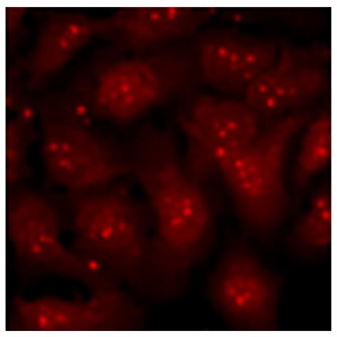 Immunofluorescence: U2-OS cells stimulated with tetradecanoylphorbol acetate and treated with MEK and p38 inhibitors were stained with anti-Bmi1 followed by ARG23780 Goat anti-Mouse IgA + IgG + IgM antibody (Texas Red) (pre-adsorbed).