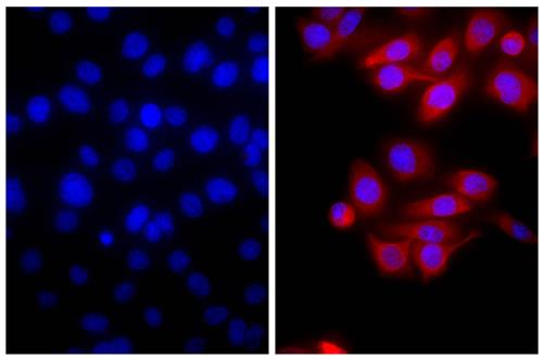 Immunofluorescence: Human pancreatic carcinoma cell line MIA PaCa-2 was stained with Mouse anti-Cytokeratin 18 (right) followed by ARG23798 Goat anti-Mouse IgG (H+L) antibody (Texas Red), pre-adsorbed and DAPI.
