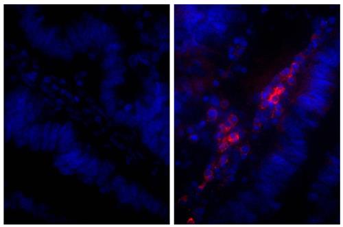 Immunohistochemistry: Paraffin-embedded Human gastric cancer tissue stained with Rabbit IgG isotype control antibody (left) and ARG23909 Rabbit anti-Human IgG (H+L) antibody (pre-adsorbed) (right), followed by anti-Rabbit IgG (H+L) antibody (Alexa Fluor 555) and DAPI.