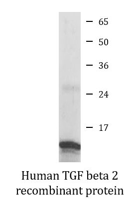 SDS-PAGE analysis of ARG70107 Human TGF beta 2 recombinant protein (Active) (His-tagged, C-ter). SDS-PAGE analysis of ARG70107 Human TGF beta 2 recombinant protein (Active) (His-tagged, C-ter).