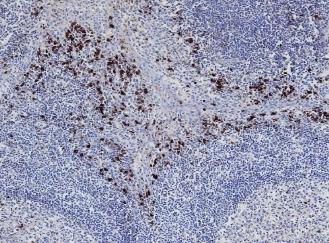 Immunohistochemistry: Formalin/PFA-fixed and paraffin-embedded Human tonsil tissue. Antigen Retrieval: Heat mediation was performed in Tris/EDTA buffer (pH 9.0). The tissue section was stained with ARG66829 Rabbit anti-Human IgA antibody [SQab20241].