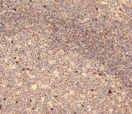 Immunohistochemistry: Formalin-fixed and paraffin-embedded Human tonsil tissue. Antigen Retrieval: Heat mediation was performed in Citrate buffer (pH 6.0). The tissue section was stained with ARG66876 Rabbit anti-Human IgM antibody [SQab21244] for 30 min at RT.