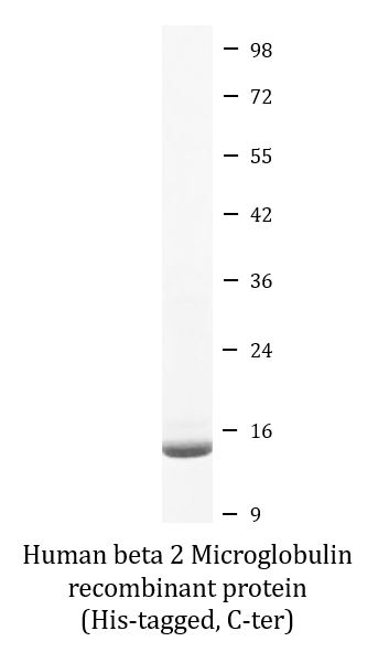 SDS-PAGE analysis of ARG70247 Human beta 2 Microglobulin recombinant protein (His-tagged, C-ter).