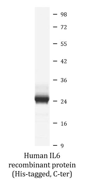SDS-PAGE analysis of ARG70272 Human IL6 recombinant protein (Active) (His-tagged, C-ter).