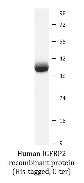 SDS-PAGE analysis of ARG70277 Human IGFBP2 recombinant protein (His-tagged, C-ter). SDS-PAGE analysis of ARG70277 Human IGFBP2 recombinant protein (His-tagged, C-ter).