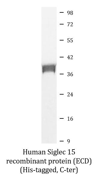 SDS-PAGE analysis of ARG70342 Human Siglec 15 recombinant protein (Active) (ECD) (His-tagged, C-ter).