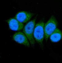 anti-ACADSB antibody (ARG45183) - arigo Biolaboratories