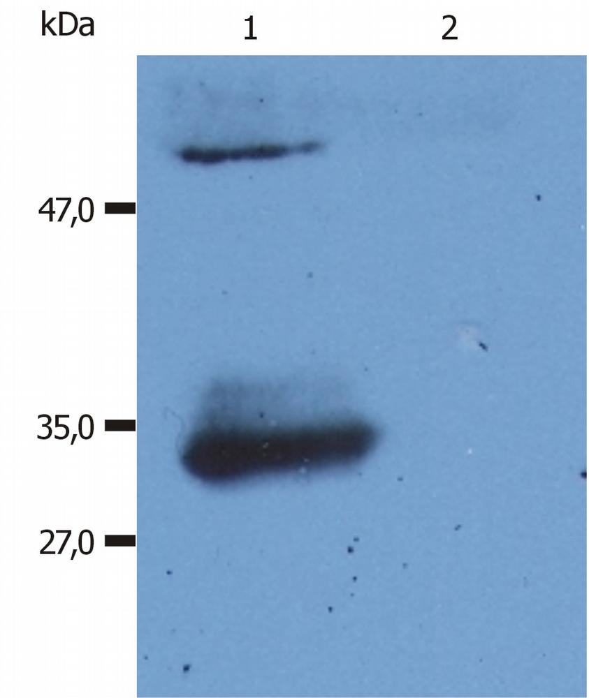 Western blot: 1) Normal human immunoglobulins, and 2) Normal bovine immunoglobulins stained with ARG63035 Mouse anti-Human IgG (Fab) antibody [4A11].