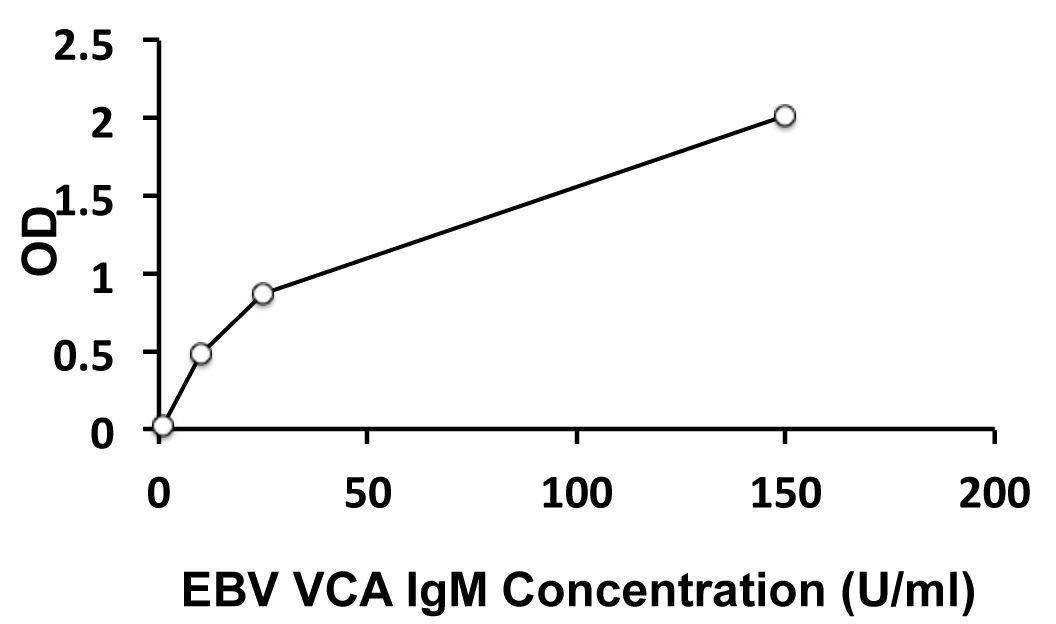 vca igm – GJRUSY