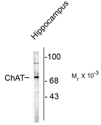 Anti Chat Antibody Arg Arigo Biolaboratories