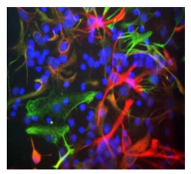 Immunofluorescence: cultured neonatal rat neurons and glia showing nestin labeling in red (ARG52345 Nestin antibody [4D11]) and vimentin (ARG52468 anti-Vimentin antibody) in green. Astrocytes and neuronal stem cells stain strongly and specifically in a clearly filamentous fashion with the anti-Nestin antibody. The presence of Nestin indicates that the cells are developing astrocytes, neuroblasts or undifferentiated neural stem cells.